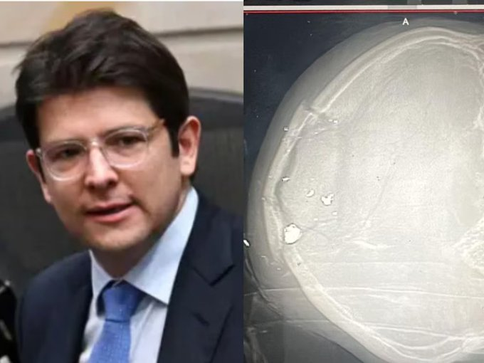 Kandidato sa Pagkapangulo sa Colombia, Binaril at Malubha ang Kondisyon!